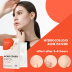 Acne Patches